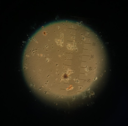Diatoms in Microscope